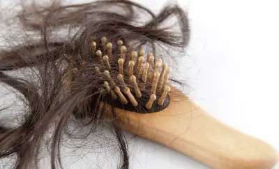8 causes of hair loss