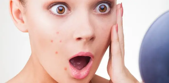 Dark spots, red marks and acne scars